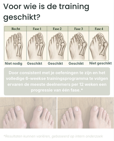 6-weekse Hallux Valgus Trainingsprogramma
