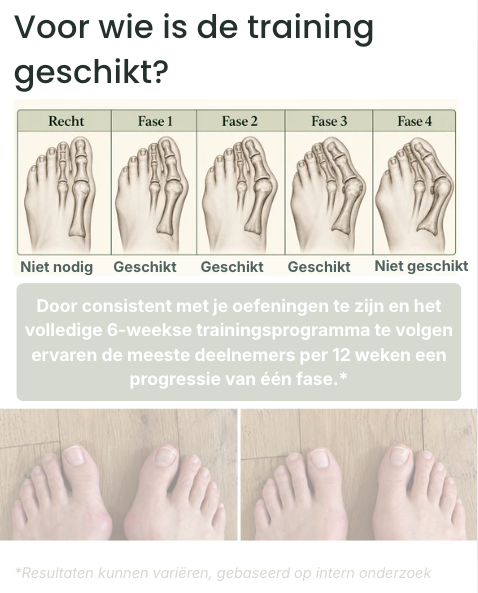 6-weekse Hallux Valgus Trainingsprogramma