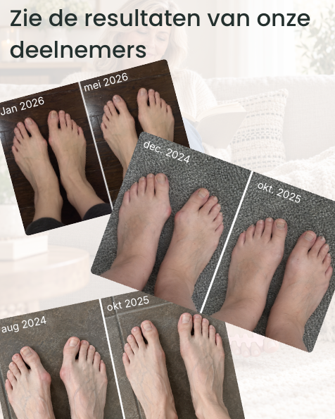 6-weekse Hallux Valgus Trainingsprogramma
